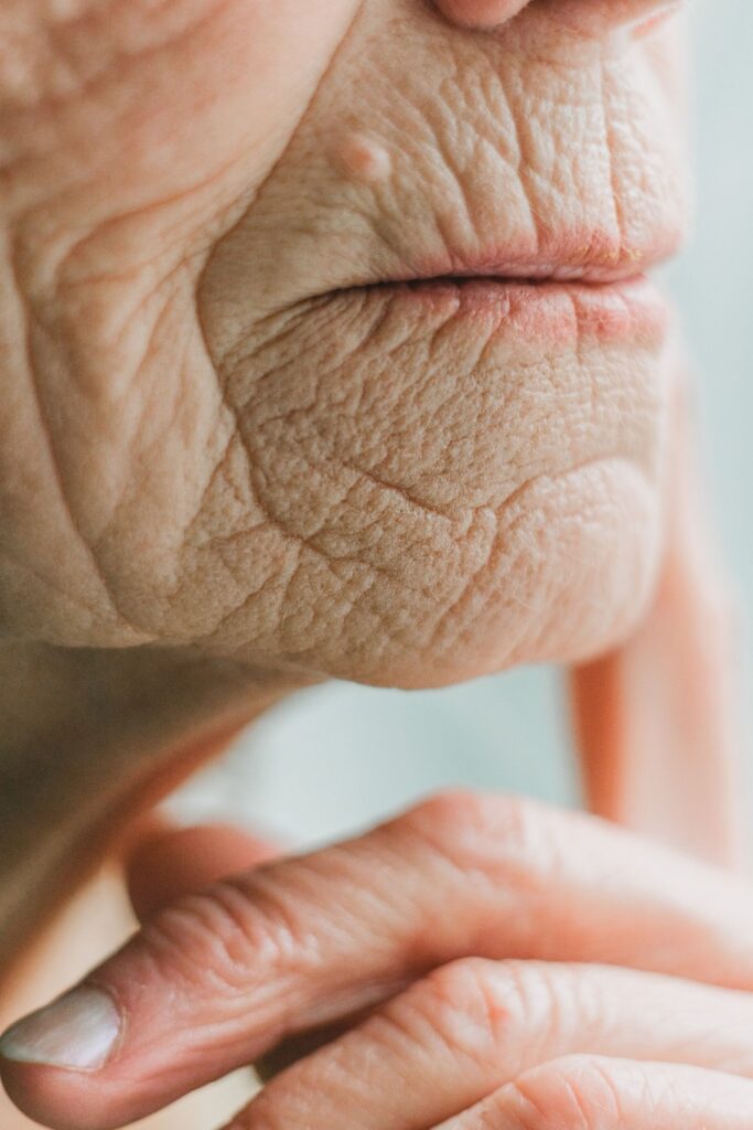Close-up of skin showing fine lines for anti-aging treatment