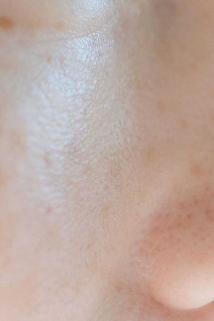 Close-up of skin texture for dark spot treatment