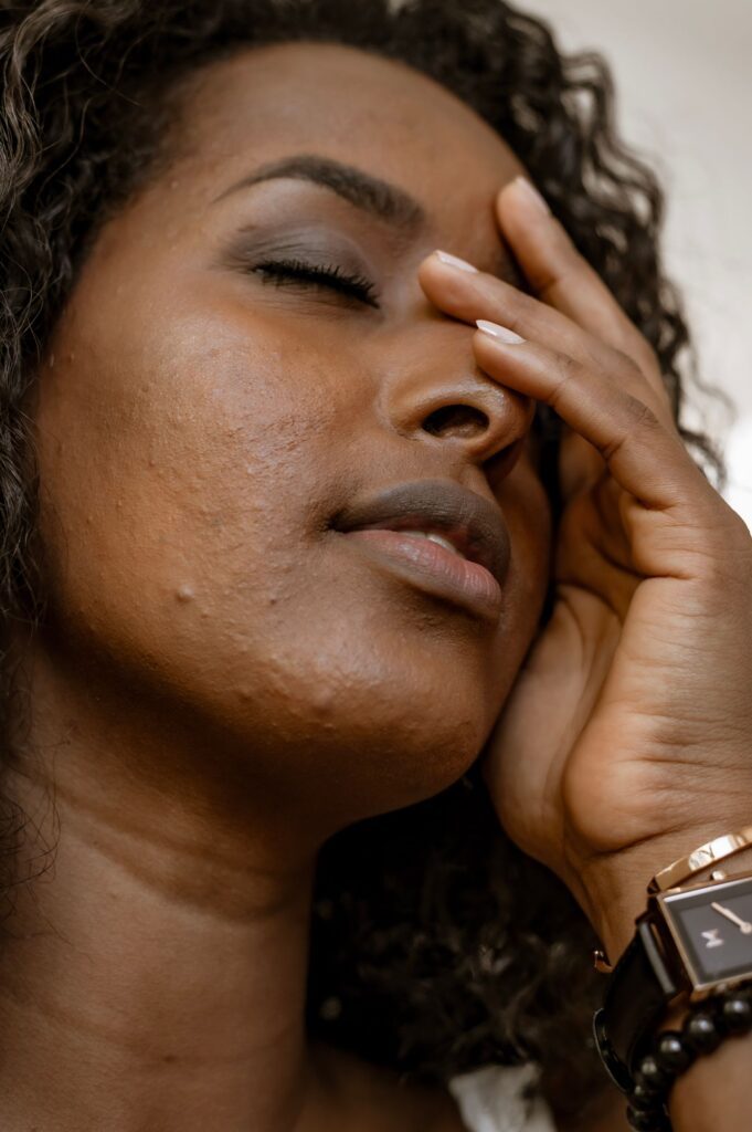 Woman with dull tired skin before treatment
