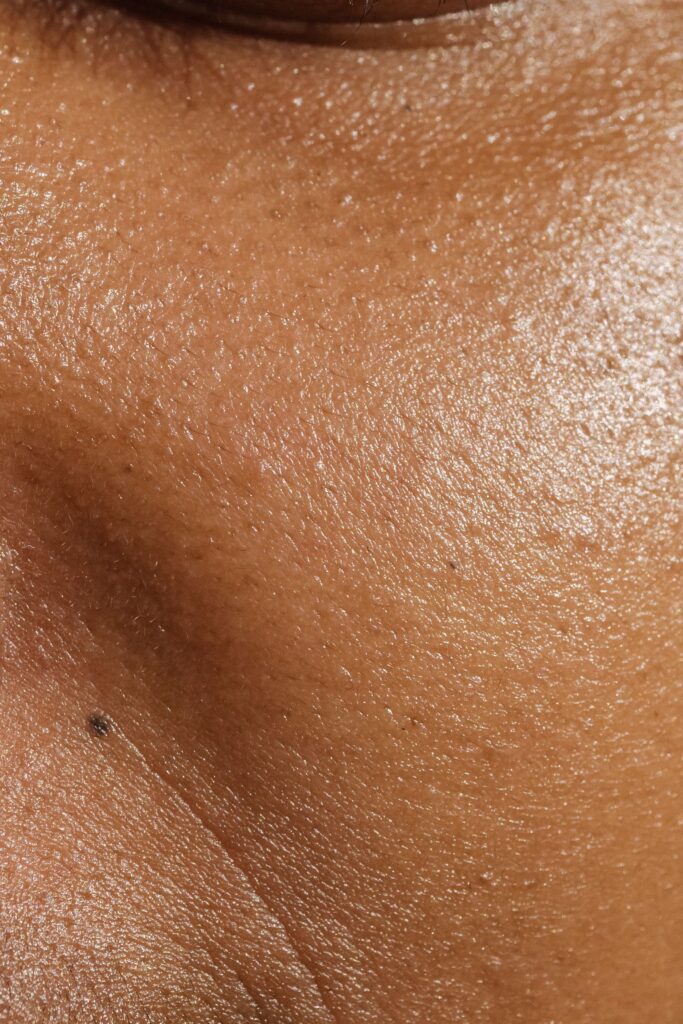 Close-up of skin texture for pigmentation treatment
