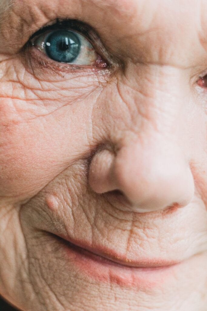 Close-up of skin wrinkles for anti-aging treatment