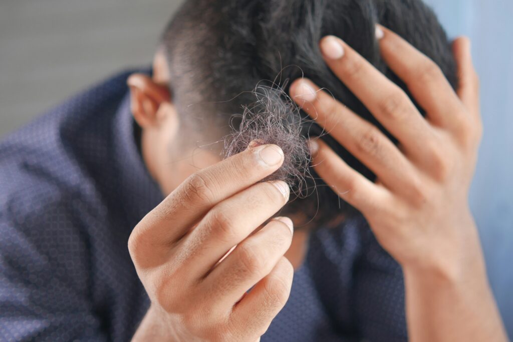 Non-Surgical Hair Restoration in Kokape